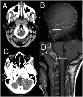 Anatomical and Physiological Differences between Children and Adults Relevant to Traumatic Brain Injury and the Implications for Clinical Assessment and Care